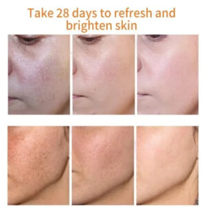 LUNOON™ Blemish Removing Beauty Cream