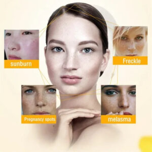 LUNOON™ Blemish Removing Beauty Cream