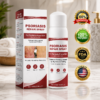 KUBOZN® Beef Tallow Spray for Itchy, Flaky Psoriasis Skin