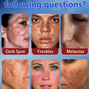 LUNOON™ Blemish Removing Beauty Cream