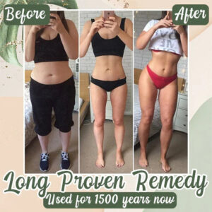 ERAYCEE Perfect Detox Slimming Patch（Limited Time Discount 🔥 Last Day）