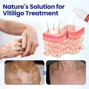 Biancat® VitiRepair Advanced Spray