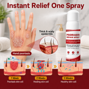 KUBOZN® Beef Tallow Spray for Itchy, Flaky Psoriasis Skin
