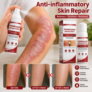 KUBOZN® Beef Tallow Spray for Itchy, Flaky Psoriasis Skin