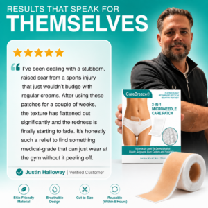 CareBreeze® 3-in-1 Scar Removal Microneedle Care Patch 💡