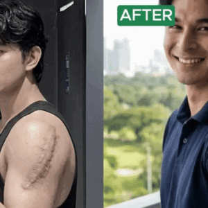 Before and after