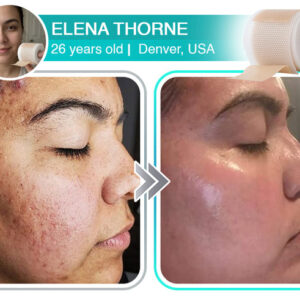 Elena review