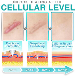 CareBreeze® 3-in-1 Scar Removal Microneedle Care Patch 💡