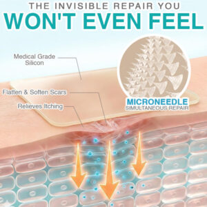 Structural remodeling