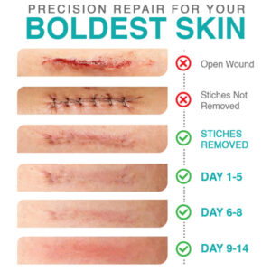14 day results