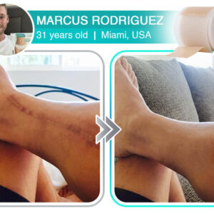 Marcus review